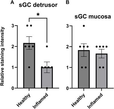 Soluble guanylate cyclase mediates the relaxation of healthy and inflamed bladder smooth muscle by aqueous nitric oxide